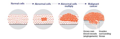 How Does Cancer Develop 的图像结果