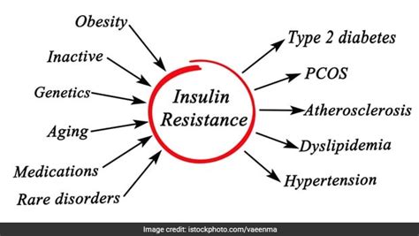 PCOS Diet: क्या है पीसीओएस? PCOS के लक्षण, कारण और बचाव, जानें कैसा हो ...