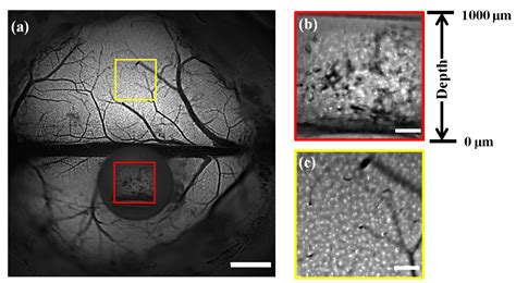 Simultaneous Observation of Mouse Cortical and Hippocampal Neural ...