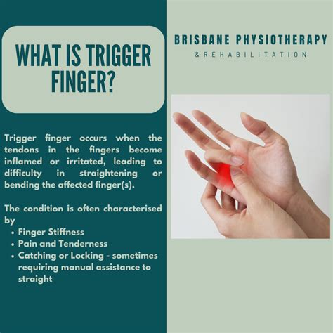 Trigger Finger Definition Etiology Symptoms Diagnosis Evaluation And