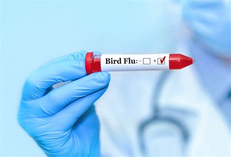 California Child Potentially Contracts Avian Flu, Human-to-Human ...
