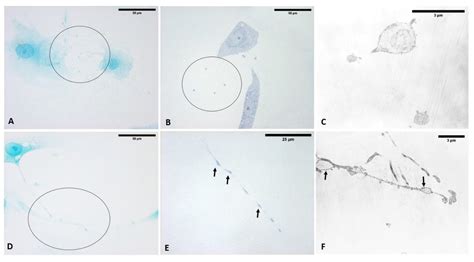 Immediate Effects of Extracorporeal Shock Wave Therapy in Fascial ...