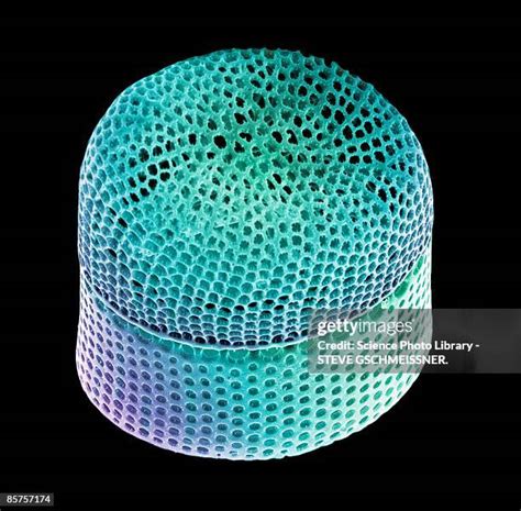 Scanning Electron Micrograph 的图像结果