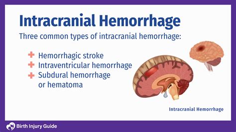 Intracranial Hemorrhage in Babies | Birth Injury Guide