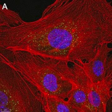 Anti-LAMP-2 Antibody, clone 1F6 ZooMAb® Rabbit Monoclonal recombinant ...