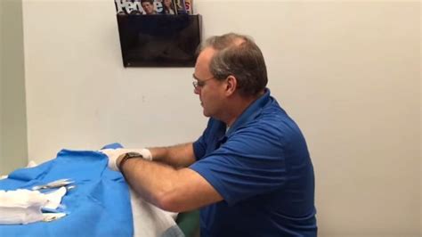 Largest Exploding Cyst 的图像结果