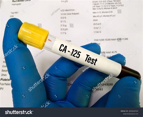 Blood Sample Ca125 Test Tumor Marker Stock Photo 2092692592 | Shutterstock