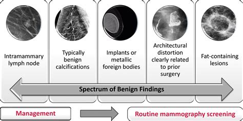 BI-RADS Terminology for Mammography Reports: What Residents Need to KnowRadioGraphics