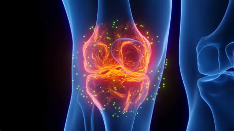 Nature Care Ayurveda | Ayurvedic Osteoarthritis Treatment