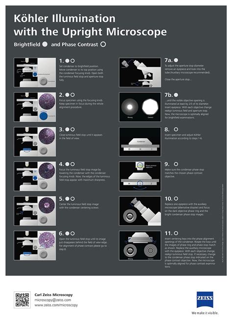 Microscope Condensers: Types, Function, and Selection