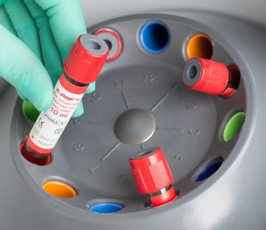 PRF Protocol 的图像结果