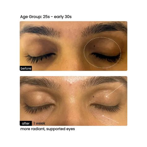 Eye Serum that everyone needs – AMINU