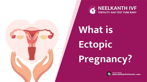 What is Ectopic Pregnancy? Causes, Symptoms & Treatment