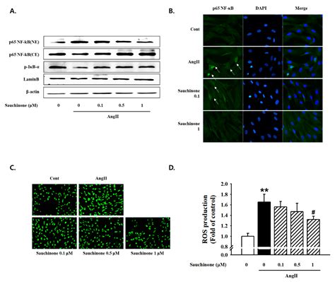 Sauchinone Protects Renal Mesangial Cell Dysfunction against ...