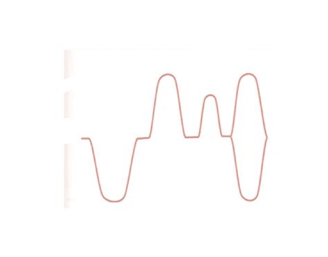 Mood Disorders Graph 的图像结果