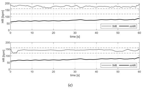 Sensors | Special Issue : Sensors and Biomedical Signal Processing for ...