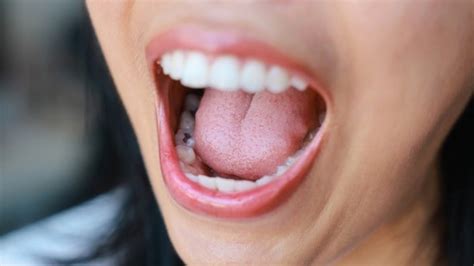 Dentist shares 4 ‘crazy things’ rotting your teeth that aren't related ...