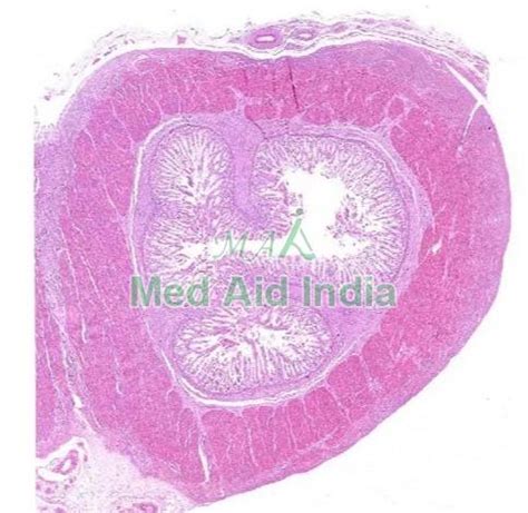 Image result for Jejunum Microscope