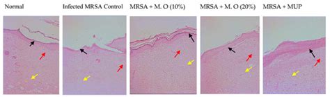Moringa oleifera Leaf Extract Promotes Healing of Infected Wounds in ...