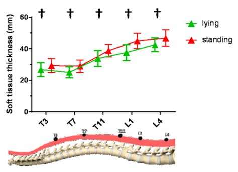 Mapping of Back Muscle Stiffness along Spine during Standing and Lying ...