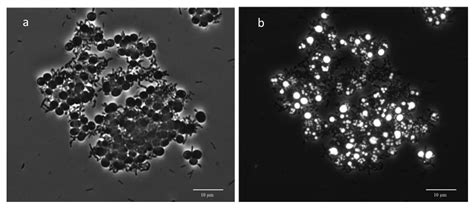 Dynamics of Microbial Communities in Phototrophic Polyhydroxyalkanoate ...
