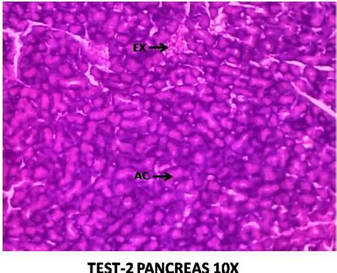 Fig. 5: Test 2 (EECS 400 mg/kg)-regenerative changes take place in ...