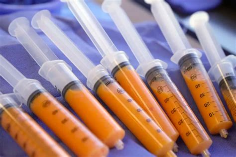 Fat Injection - How success are dental implants?