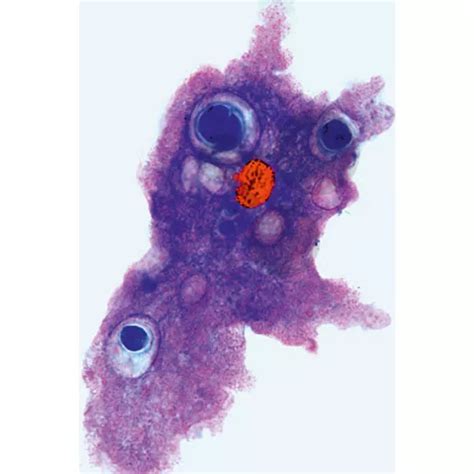 Multimediapaket Lehrer: Protozoen Basissatz 6 Einheiten