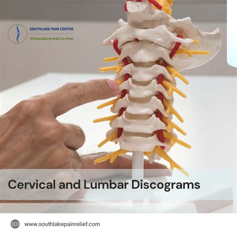 Image result for Lumbar Discogram
