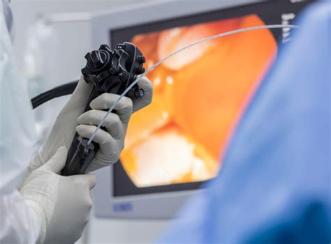 ERCP Technology for Cancer Diagnosis - Apollo Cancer Centres
