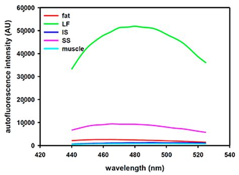 Double Assurance of Epidural Space Detection Using Fiberoptics-Based ...