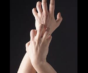 Chronic itching reduces quality of life | TopNews