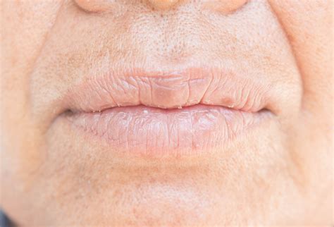 How to prevent dry mouth at night - Jackson Dental
