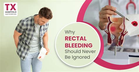 Why Rectal Bleeding Should Never Be Ignored
