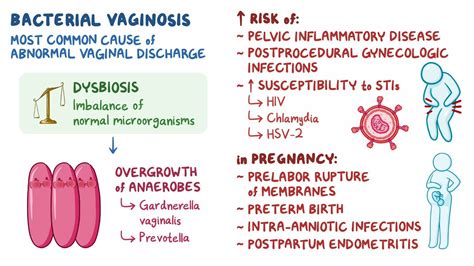 Video: Bacterial vaginosis: Clinical sciences | Osmosis