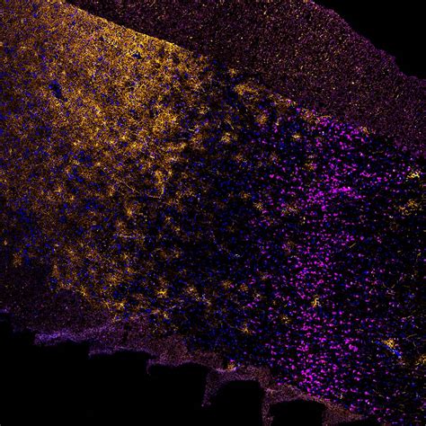 Image result for Dorsolateral Prefrontal Cortex