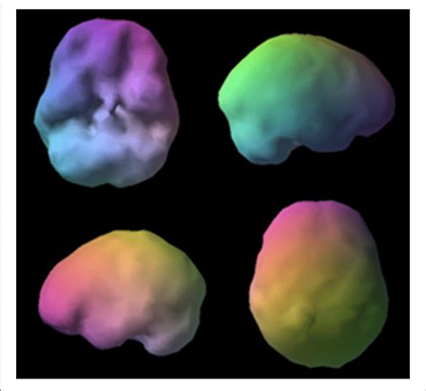 Image result for SPECT Scan Brain Prefrontal Cortex