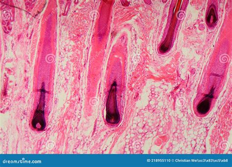 Human Hair Follicle In Skin Under The Microscope Stock Photography ...