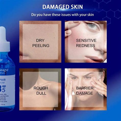 Thousand Whale Vitamin B5 Repair Serum Soothes, Repairs, Moisturizes ...