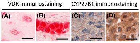 Expression of Vitamin D Receptor (VDR) Positively Correlates with ...