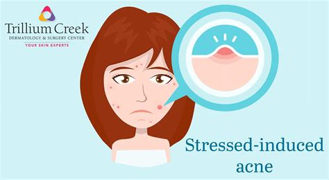 Stressing About Stress-Induced Acne? - Trillium Creek Dermatology