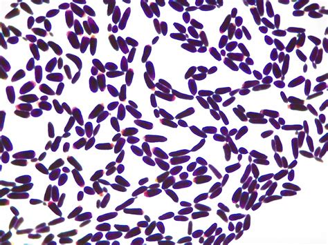 Micrograph Candida albicans Gram stain 1000x p000027 | OER Commons