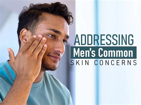 Skincare for Men: Addressing Common Skin Concerns – White Wolf India