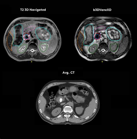 Image result for Elekta Unity Model