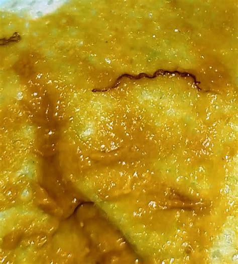 Pinworms In Toddler Poop