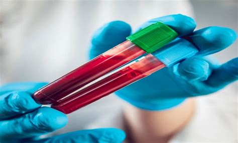 New blood test to boost diagnosis for rare genetic diseases in kids