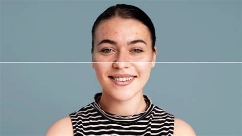 Black Head Tamil Beauty Tips | கரும்புள்ளிகள் வர காரணம் | karumpullikal ...