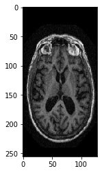 Image result for Python for MRI Data Processing