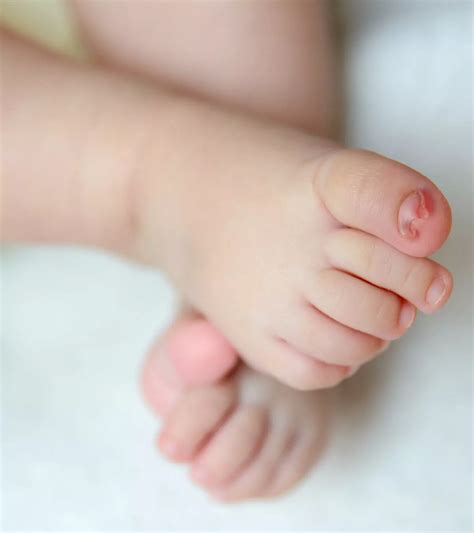 Common Infant And Newborn Problems: 15 Essential Care Tips