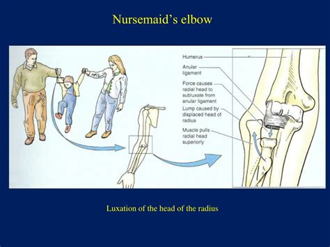 PPT - Elbow joint ( articulatio cubiti ) PowerPoint Presentation, free ...